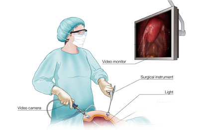 laparoscopic surgeon in hamirpur