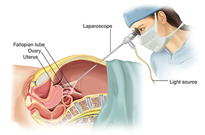 best laparoscopic surgery hamirpur